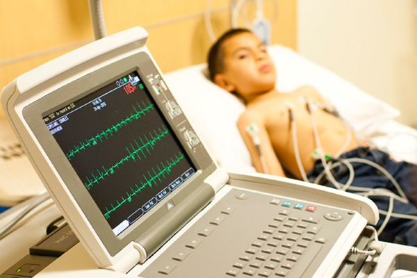 ECG